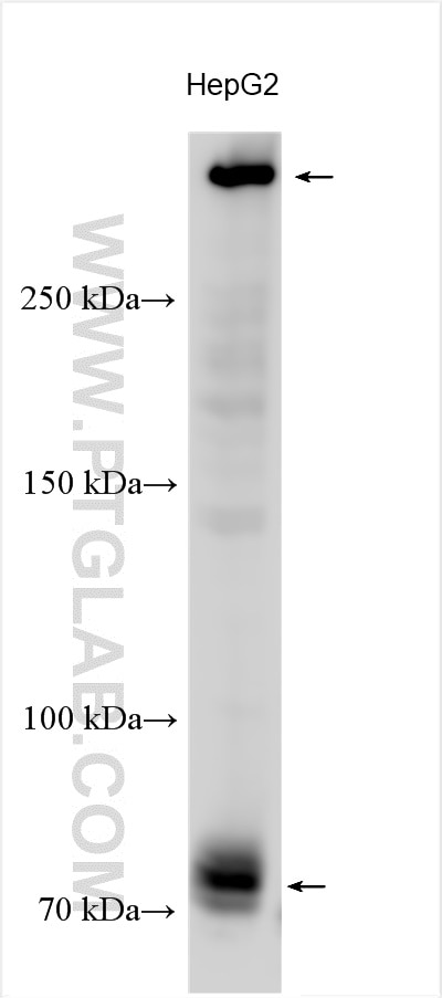 Western Blot (WB) analysis of various lysates using Dystrophin Polyclonal antibody (12715-1-AP)