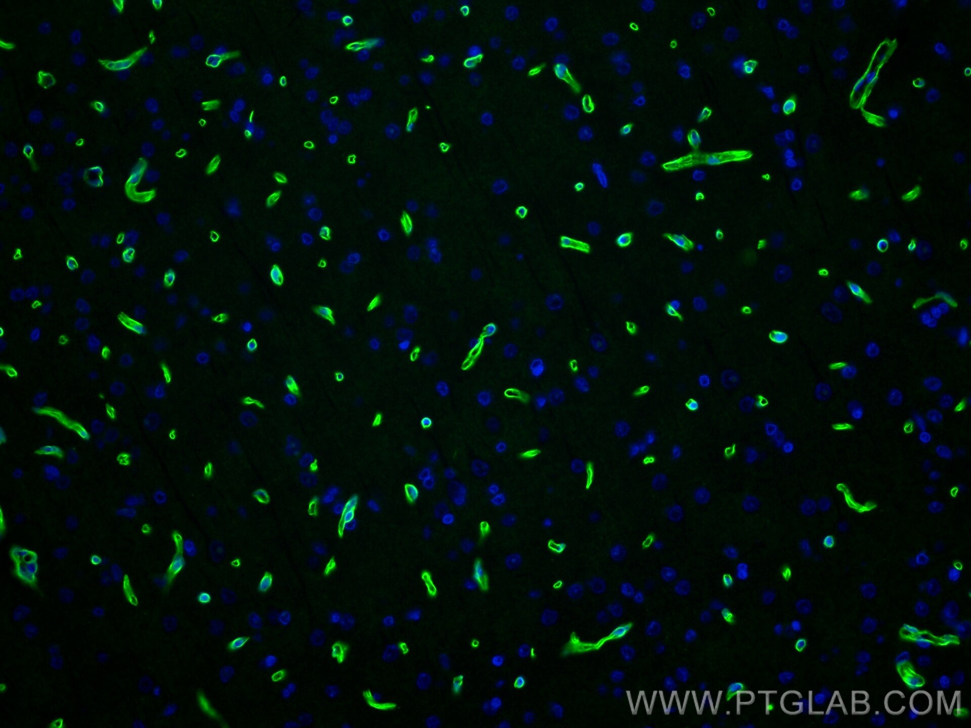 Immunofluorescence (IF) / fluorescent staining of rat brain tissue using Dystrophin Recombinant antibody (83609-6-RR)