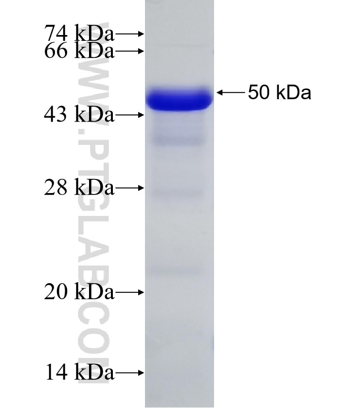 DMD fusion protein Ag4392 SDS-PAGE