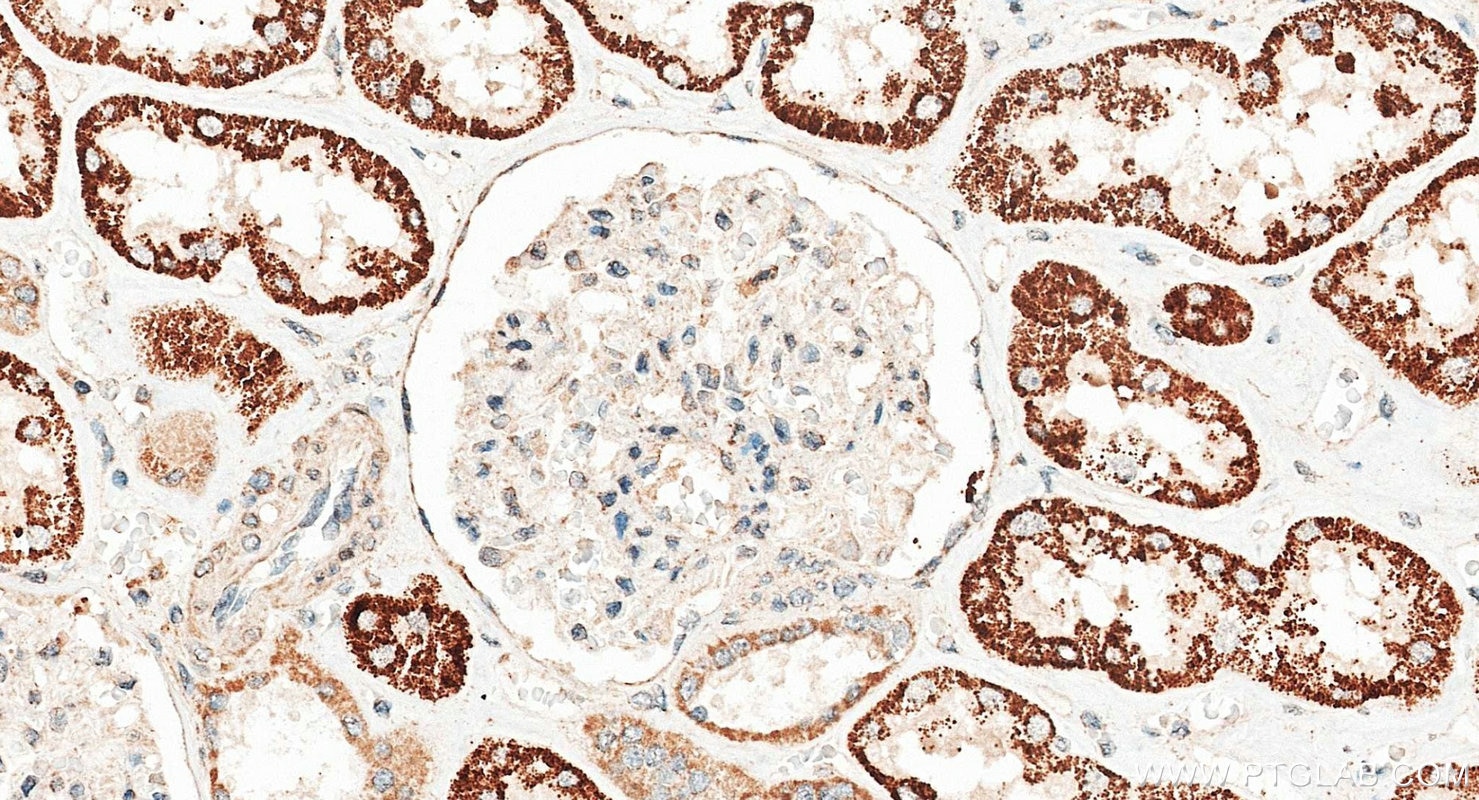 Immunohistochemistry (IHC) staining of human kidney tissue using DMGDH Polyclonal antibody (24813-1-AP)