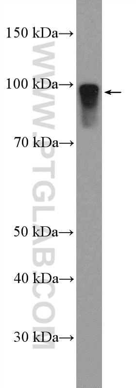 Western Blot (WB) analysis of rat liver tissue using DMGDH Polyclonal antibody (24813-1-AP)