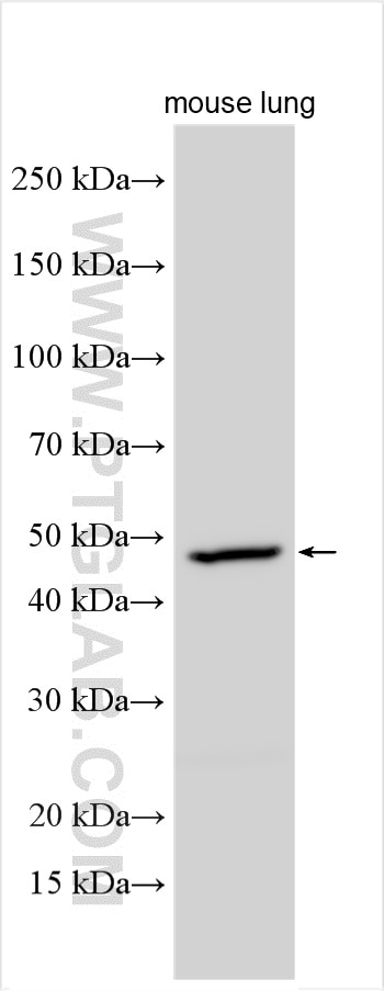 Western Blot (WB) analysis of various lysates using DMKN Polyclonal antibody (16252-1-AP)
