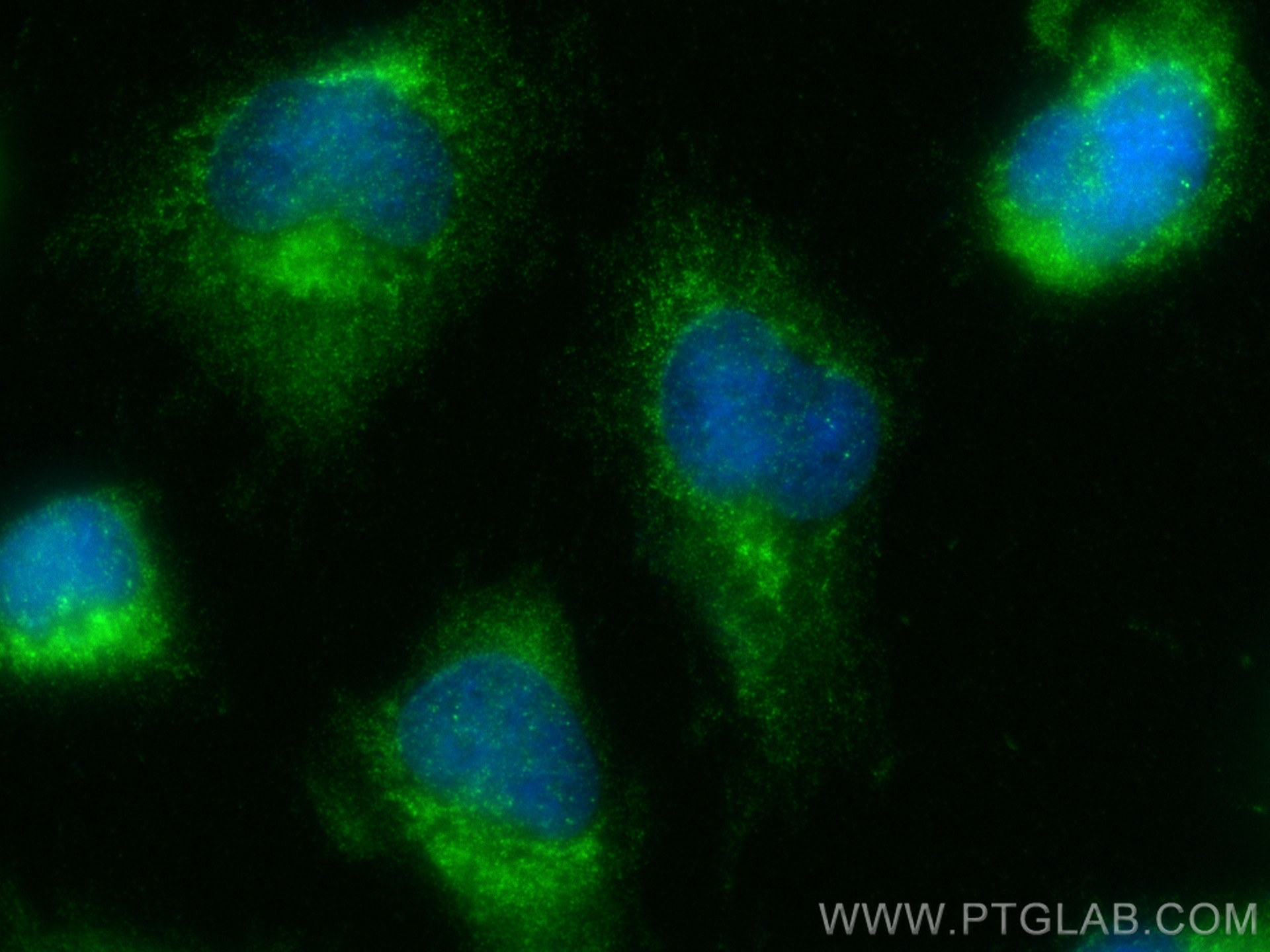 Immunofluorescence (IF) / fluorescent staining of U-251 cells using DMPK Polyclonal antibody (16711-1-AP)