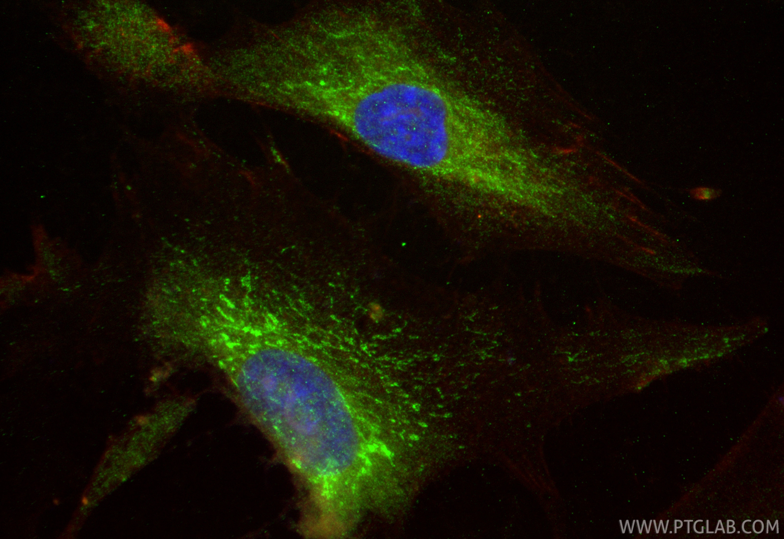 Immunofluorescence (IF) / fluorescent staining of HSkMC cells using DMPK Polyclonal antibody (16711-1-AP)