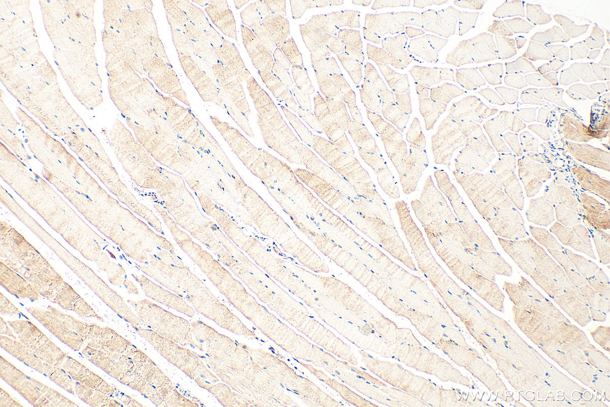 Immunohistochemistry (IHC) staining of mouse skeletal muscle tissue using DMPK Polyclonal antibody (16711-1-AP)