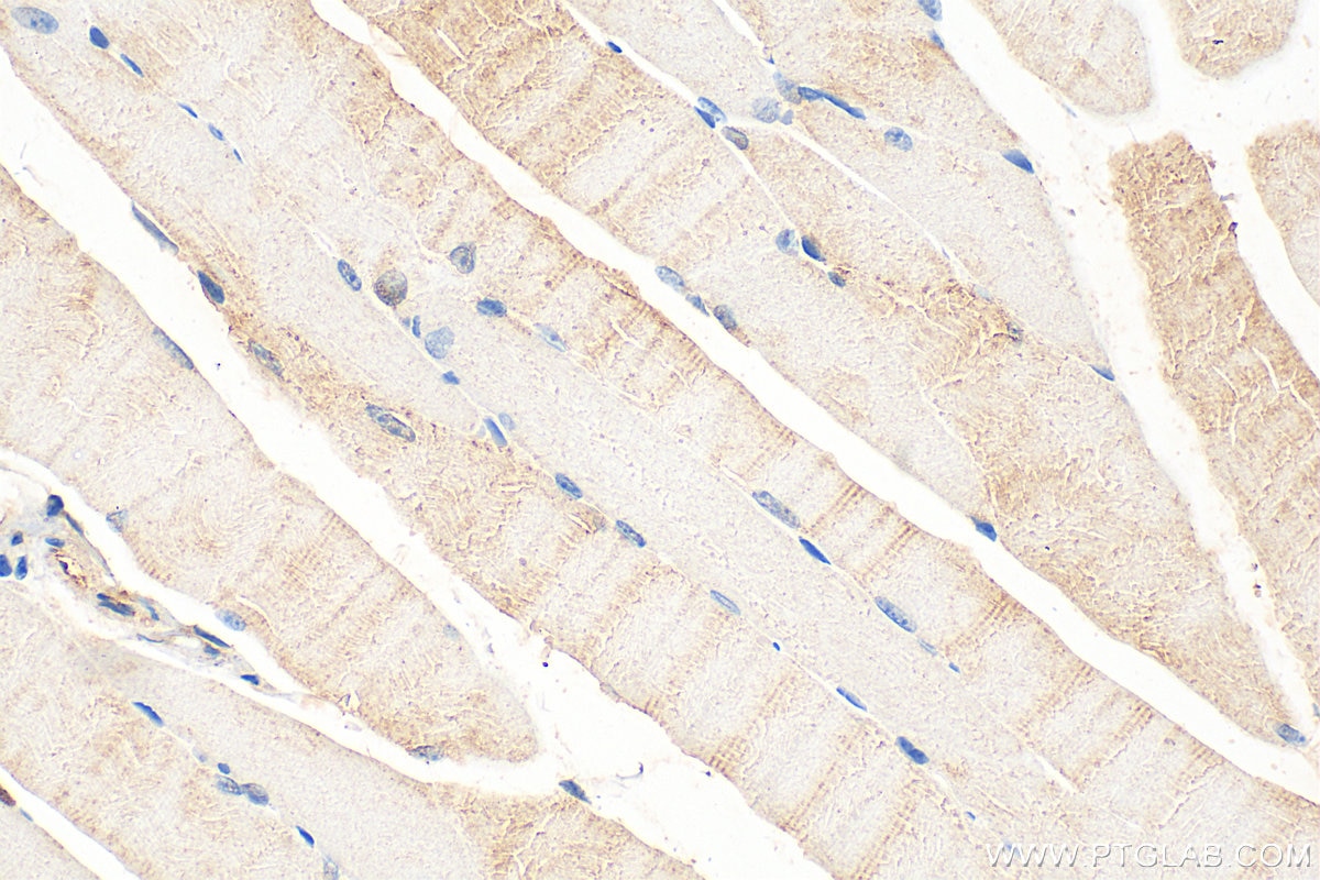 Immunohistochemistry (IHC) staining of mouse skeletal muscle tissue using DMPK Polyclonal antibody (16711-1-AP)