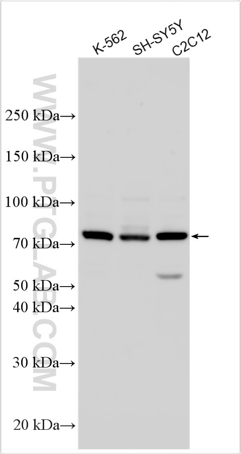 Western Blot (WB) analysis of various lysates using DMPK Polyclonal antibody (16711-1-AP)