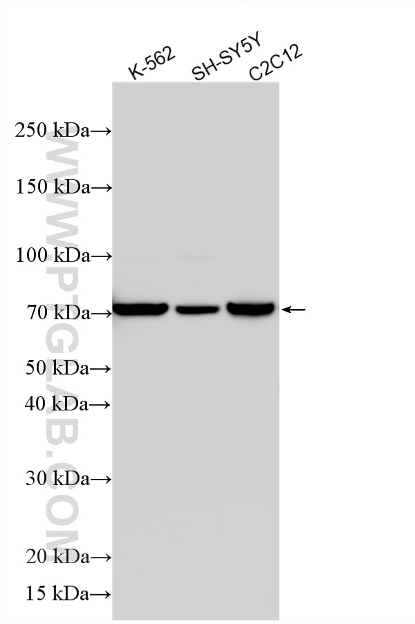 Various lysates were subjected to SDS PAGE followed by western blot with 16711-1-AP (DMPK antibody) at dilution of 1:1500 incubated at room temperature for 1.5 hours. Western Blot (WB) analysis of various lysates using DMPK Polyclonal antibody (16711-1-AP)