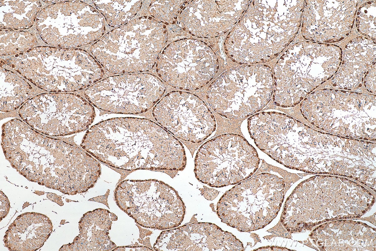 IHC staining of mouse testis using 14313-1-AP