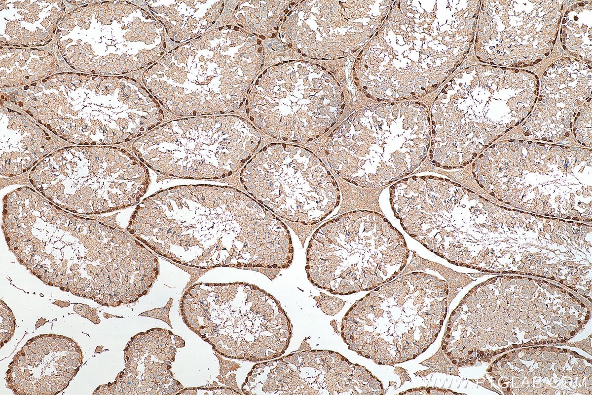 Immunohistochemistry (IHC) staining of mouse testis tissue using DMRT1 Polyclonal antibody (14313-1-AP)