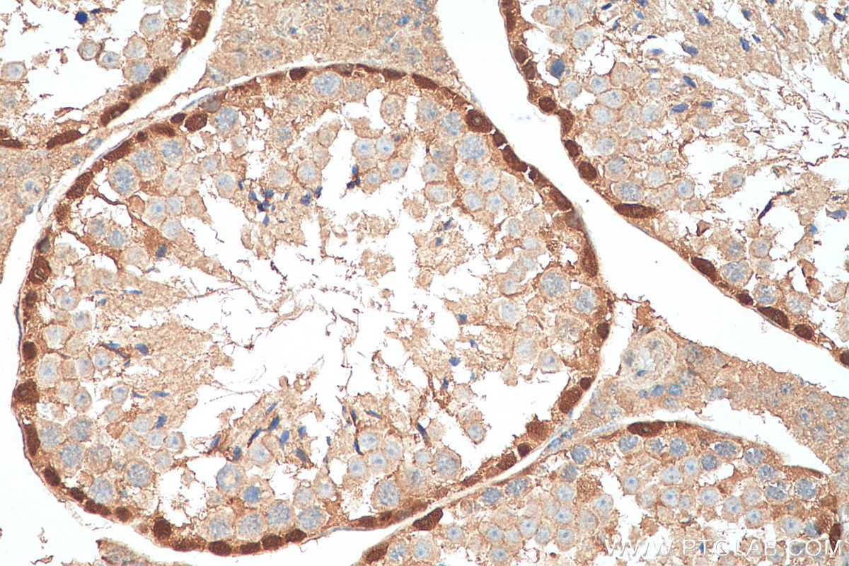 Immunohistochemistry (IHC) staining of mouse testis tissue using DMRT1 Polyclonal antibody (14313-1-AP)