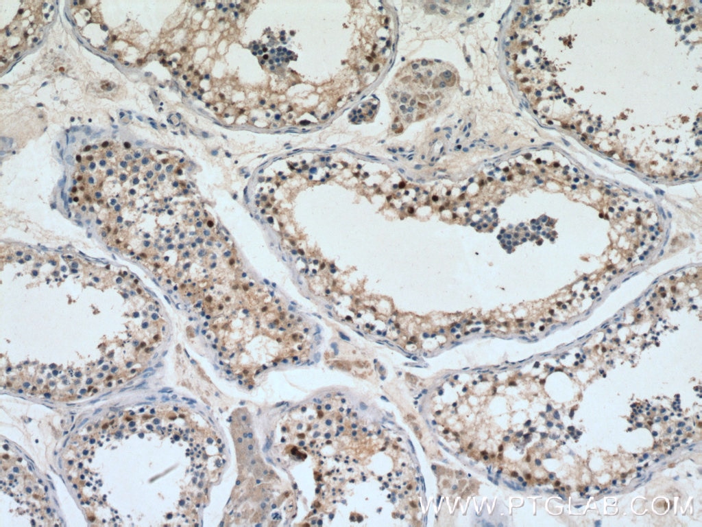 IHC staining of human testis using 14313-1-AP