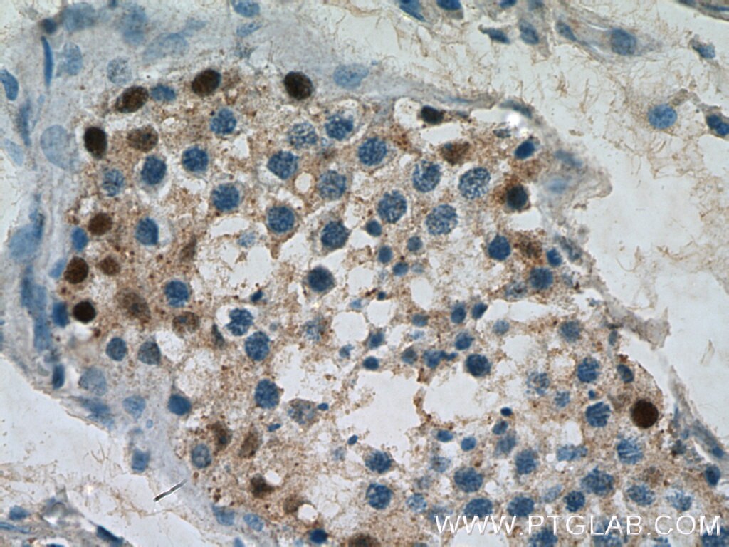 Immunohistochemistry (IHC) staining of human testis tissue using DMRT1 Polyclonal antibody (14313-1-AP)