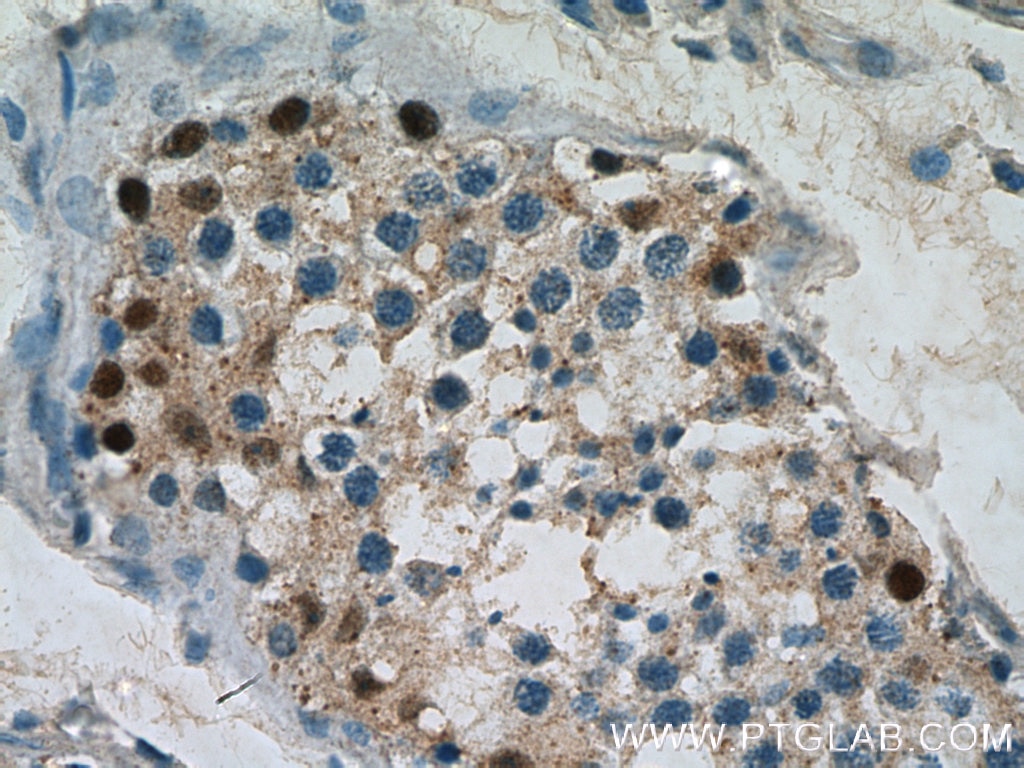 IHC staining of human testis using 14313-1-AP