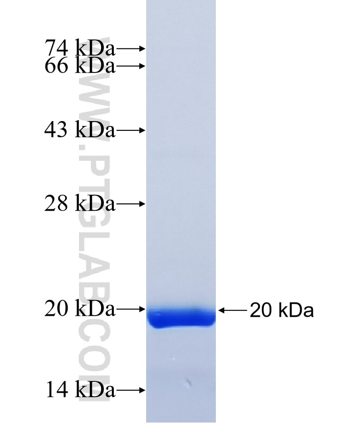 DMRT2 fusion protein Ag41154 SDS-PAGE