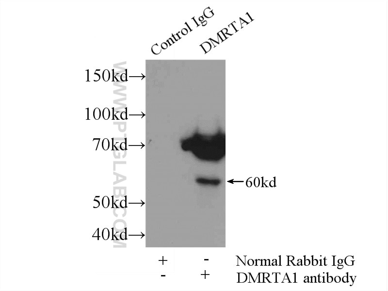 Immunoprecipitation (IP) experiment of mouse liver tissue using DMRTA1 Polyclonal antibody (24356-1-AP)