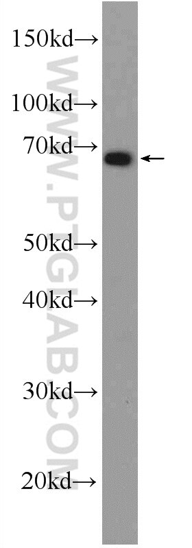 Western Blot (WB) analysis of mouse liver tissue using DMRTA1 Polyclonal antibody (24356-1-AP)