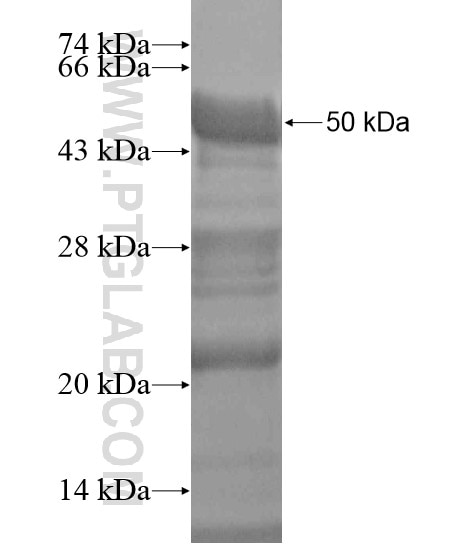 DMRTA1 fusion protein Ag18796 SDS-PAGE