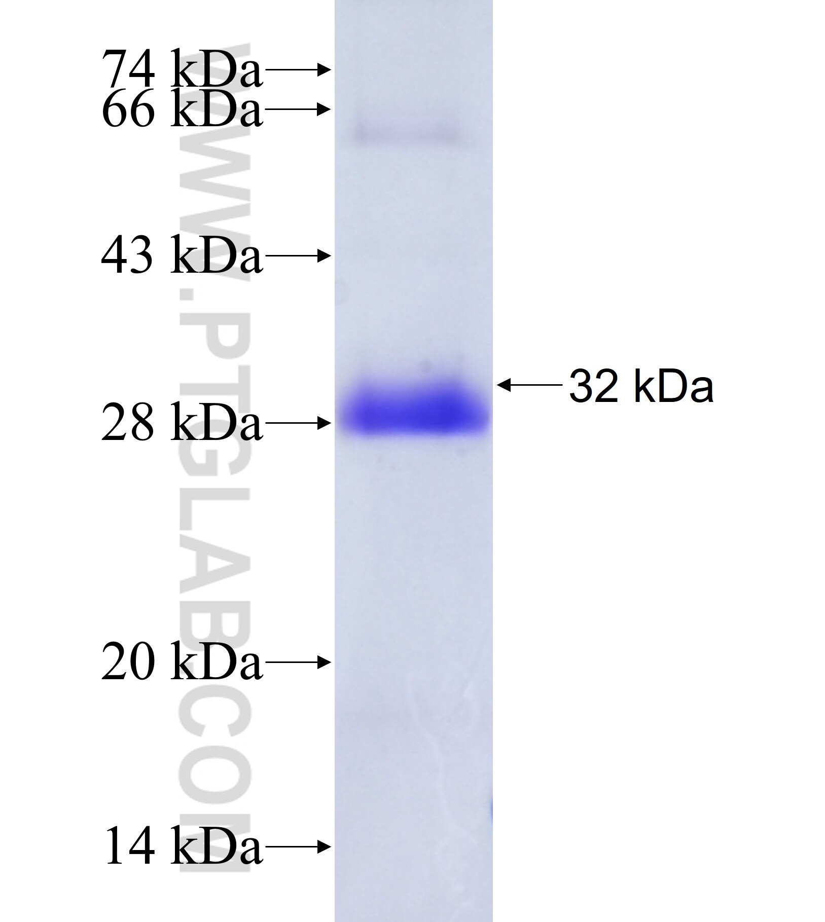 DMRTA2 fusion protein Ag41367 SDS-PAGE DMRTA2 fusion protein Ag41367 SDS-PAGE