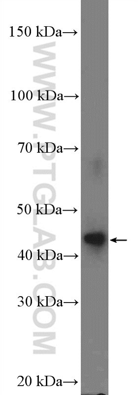 Western Blot (WB) analysis of human testis tissue using DMRTB1 Polyclonal antibody (26118-1-AP)