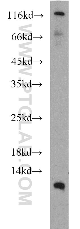 Western Blot (WB) analysis of MCF-7 cells using DMRTC1B Polyclonal antibody (21473-1-AP)