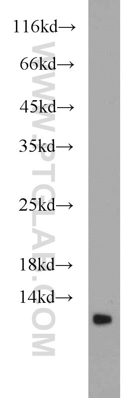 WB analysis of mouse spleen using 21473-1-AP