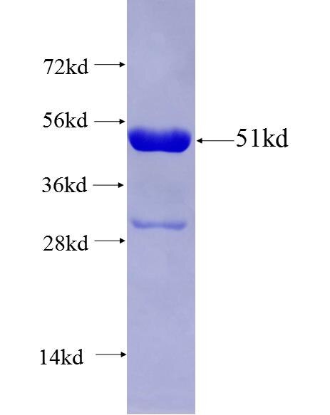 DMRTC2 fusion protein Ag27355 SDS-PAGE