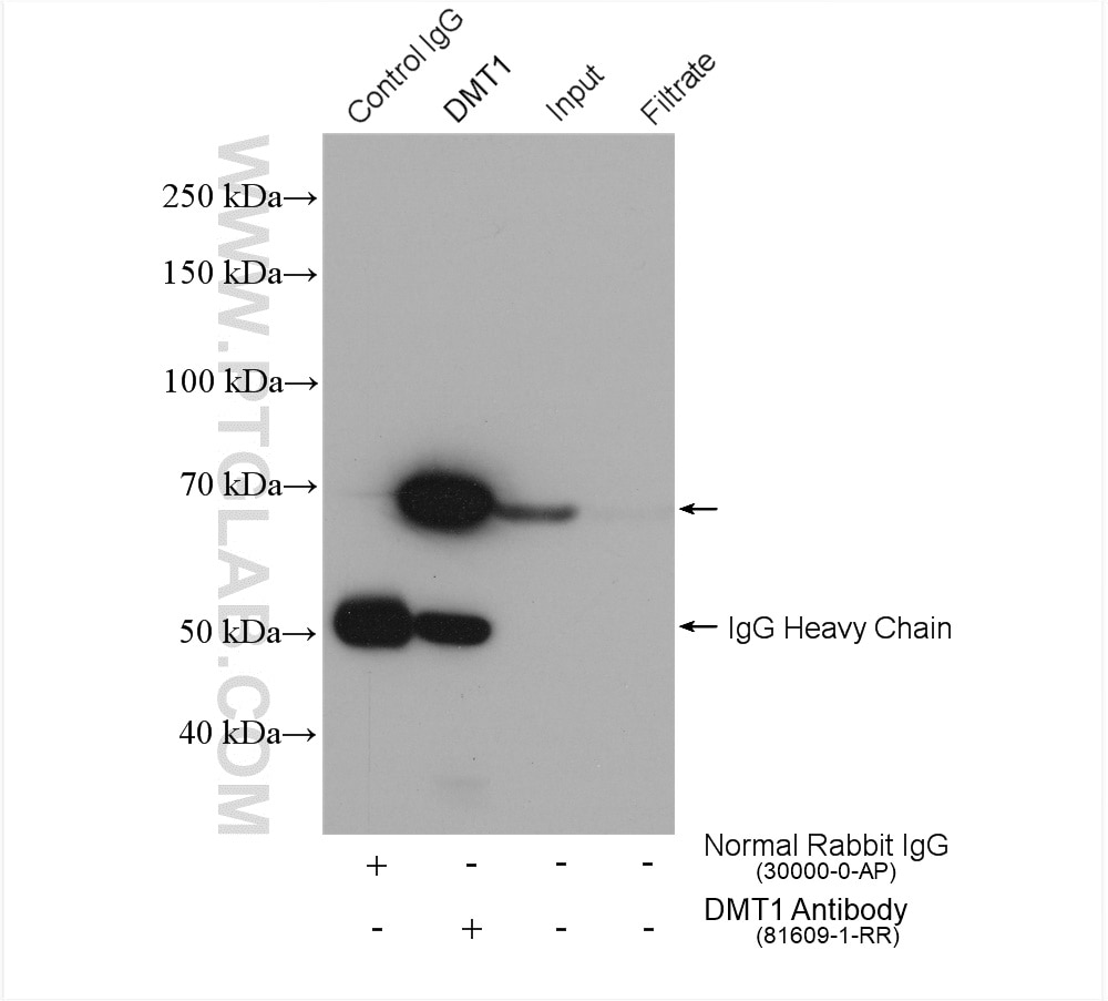 Immunoprecipitation (IP) experiment of HEK-293 cells using DMT1 Recombinant antibody (81609-1-RR)