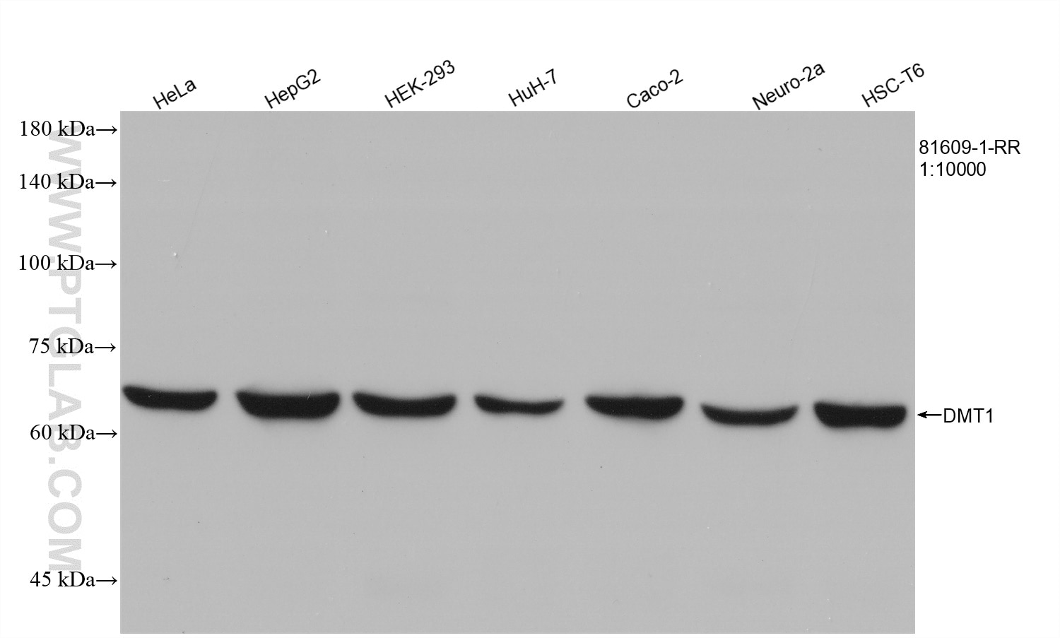 Western Blot (WB) analysis of various lysates using DMT1 Recombinant antibody (81609-1-RR)