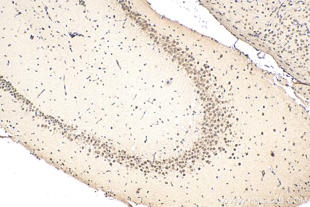 Immunohistochemistry (IHC) staining of mouse brain tissue using DMWD Polyclonal antibody (16070-1-AP)