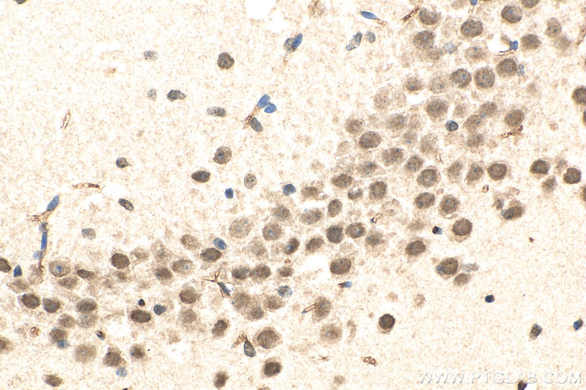 Immunohistochemistry (IHC) staining of mouse brain tissue using DMWD Polyclonal antibody (16070-1-AP)