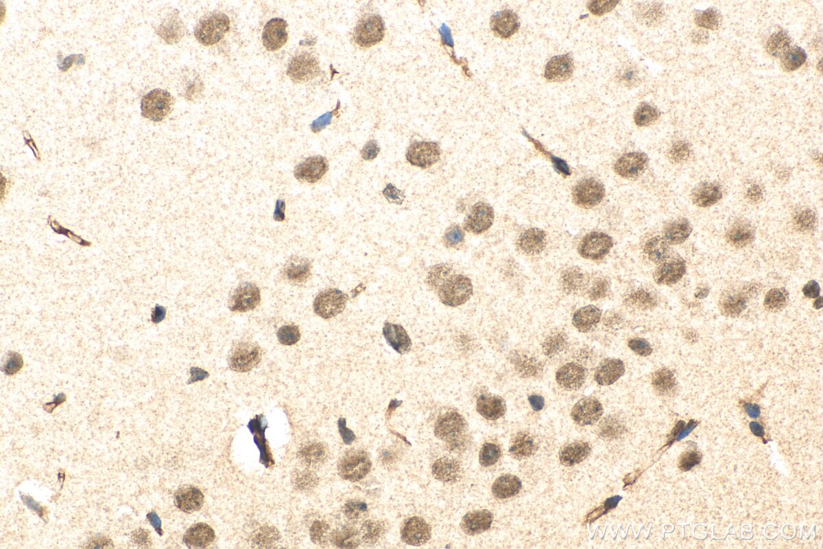 Immunohistochemistry (IHC) staining of mouse brain tissue using DMWD Polyclonal antibody (16070-1-AP)