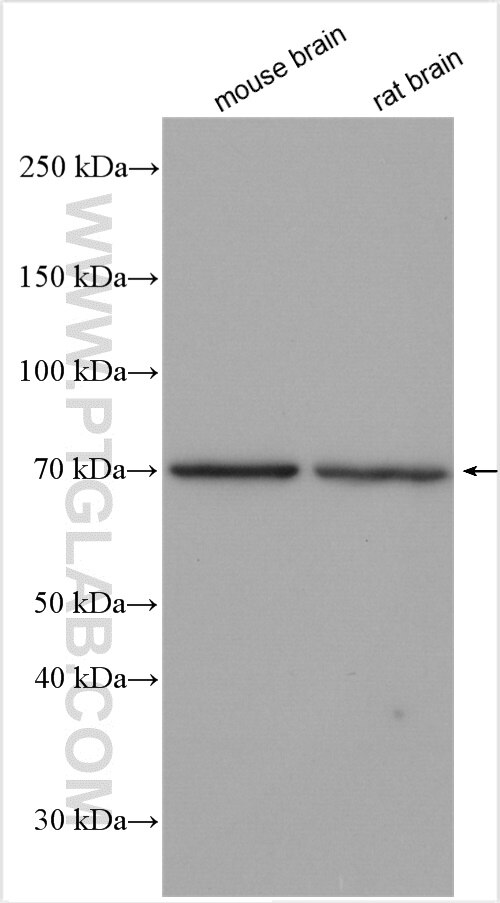 Western Blot (WB) analysis of various lysates using DMWD Polyclonal antibody (16070-1-AP)