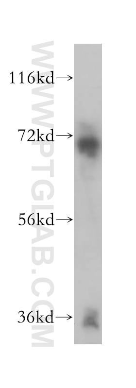 Western Blot (WB) analysis of human brain tissue using DMWD Polyclonal antibody (16070-1-AP)