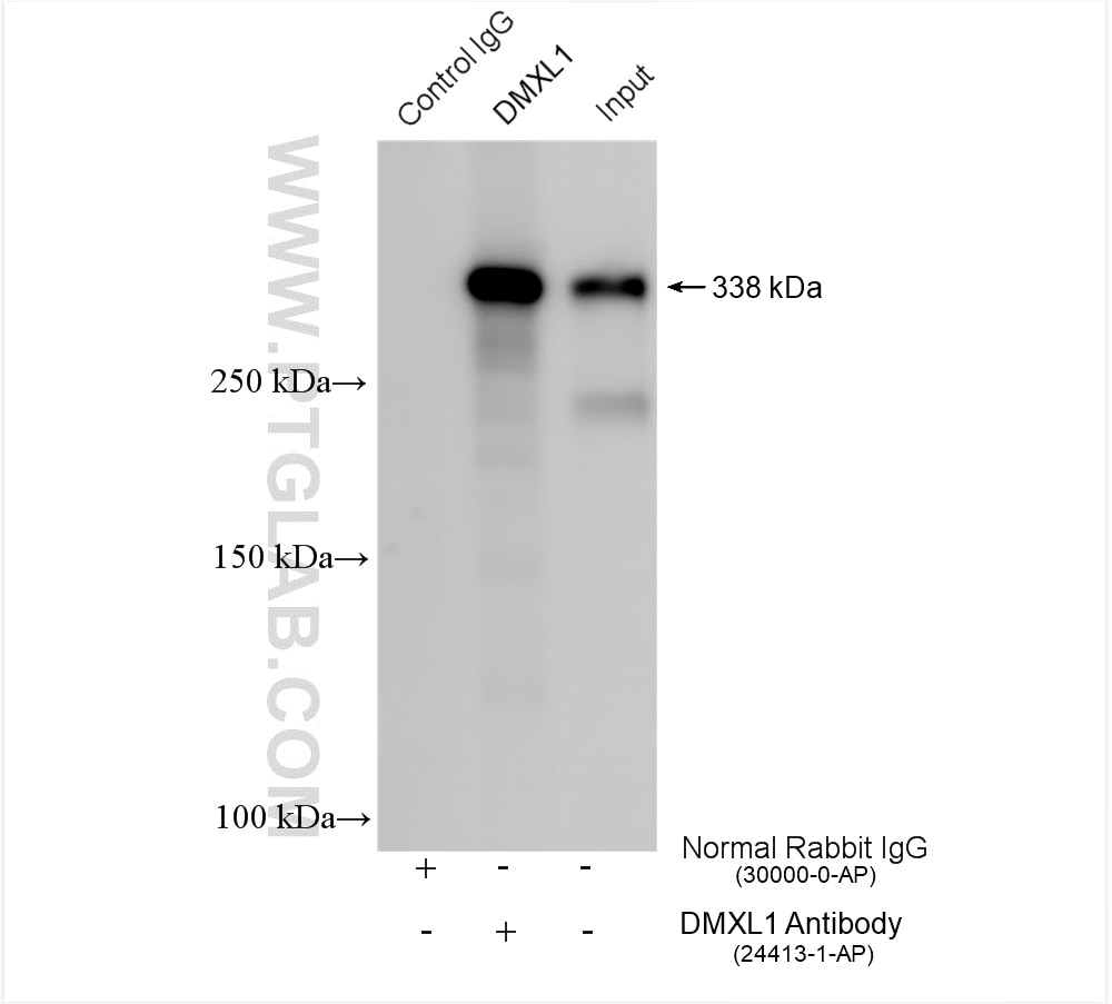 Immunoprecipitation (IP) experiment of HEK-293 cells using DMXL1 Polyclonal antibody (24413-1-AP)