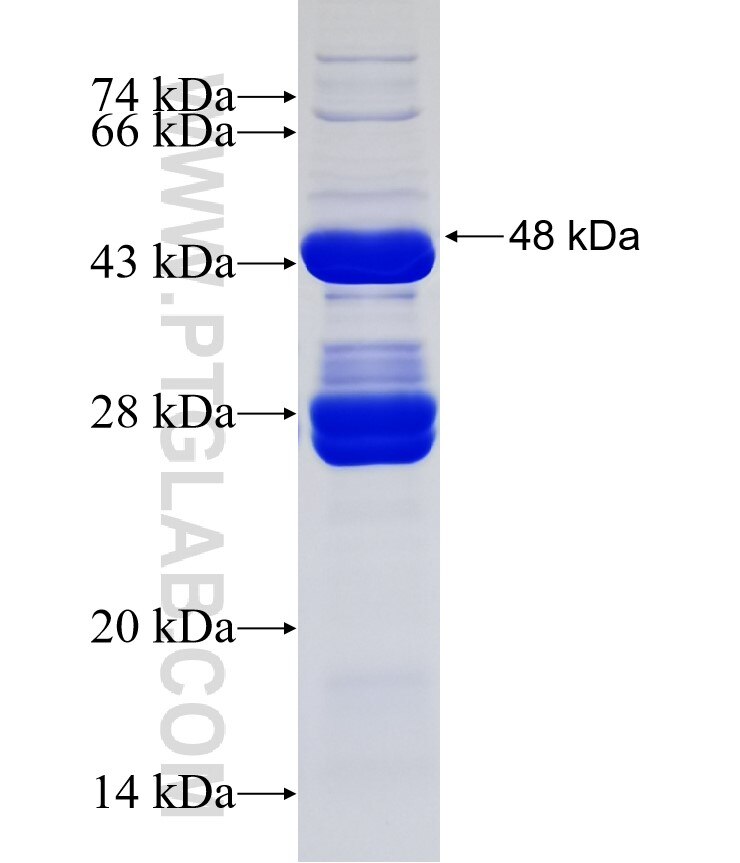DMXL1 fusion protein Ag19846 SDS-PAGE