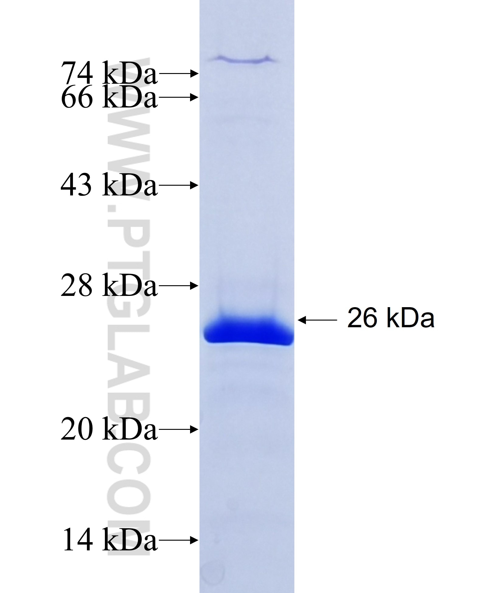 DMXL1 fusion protein Ag20008 SDS-PAGE