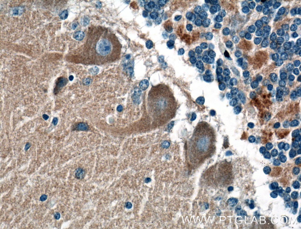 Immunohistochemistry (IHC) staining of human cerebellum tissue using DMXL2 Polyclonal antibody (24415-1-AP)