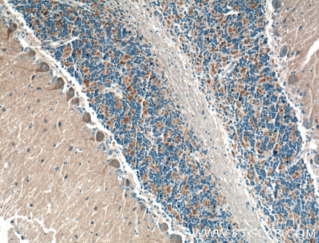 Immunohistochemistry (IHC) staining of human cerebellum tissue using DMXL2 Polyclonal antibody (24415-1-AP)