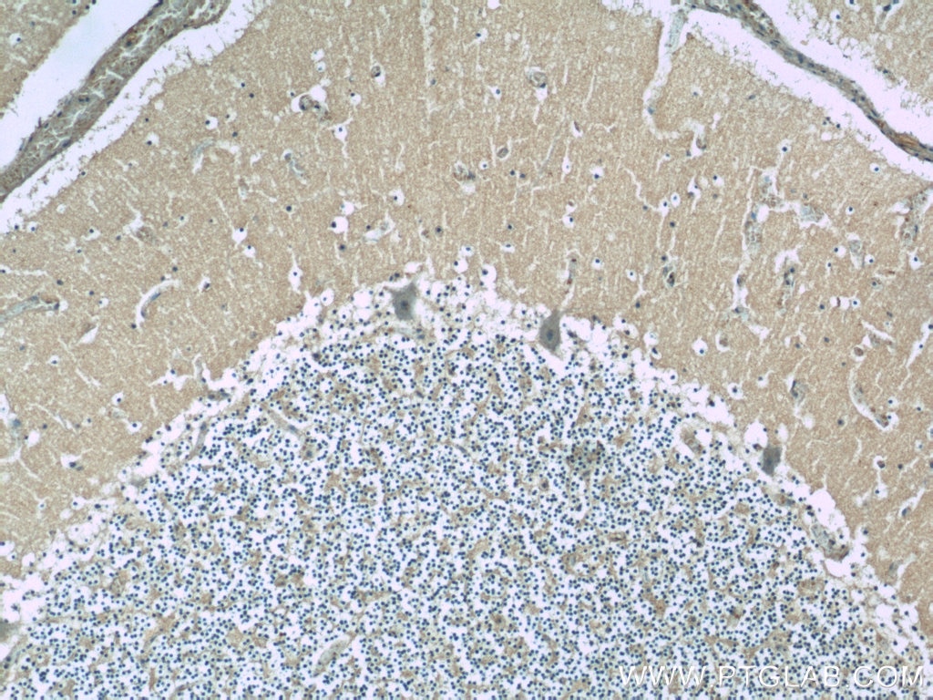 IHC staining of human cerebellum using 24415-1-AP