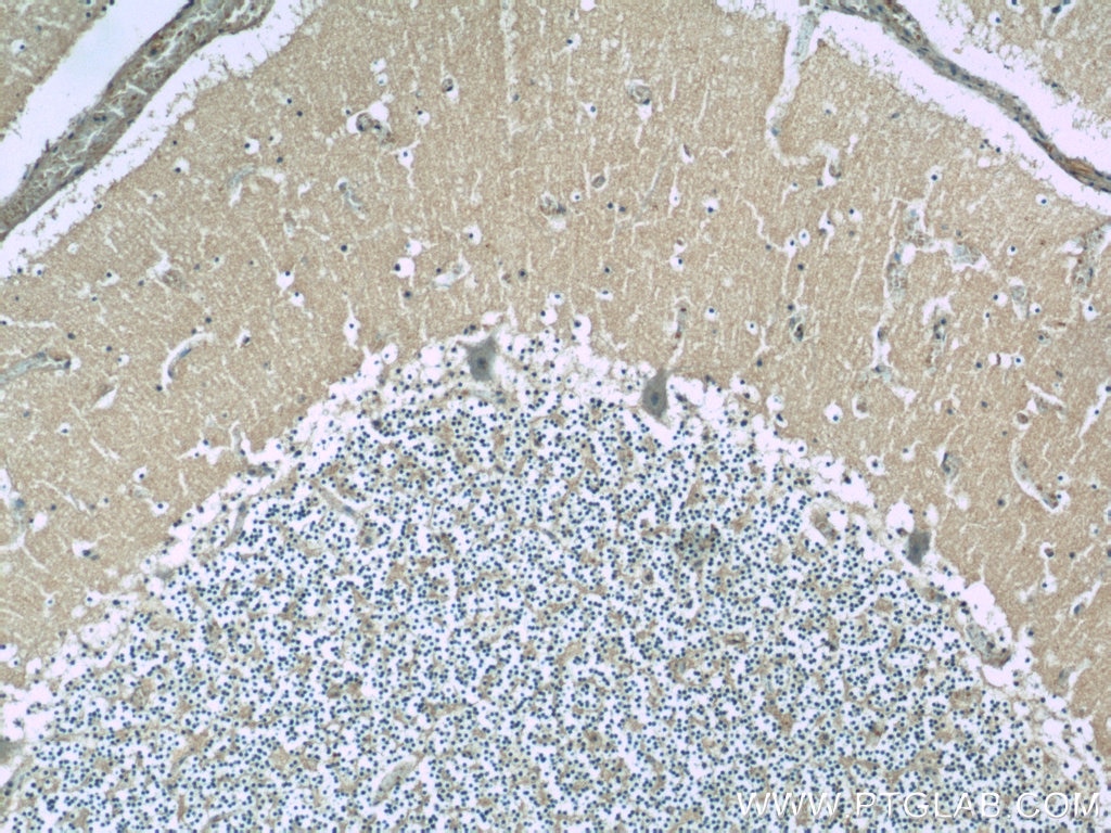 Immunohistochemistry (IHC) staining of human cerebellum tissue using DMXL2 Polyclonal antibody (24415-1-AP)