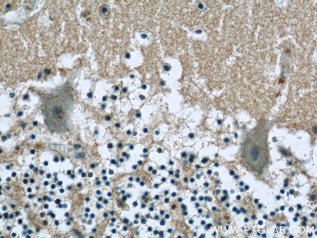 IHC staining of human cerebellum using 24415-1-AP