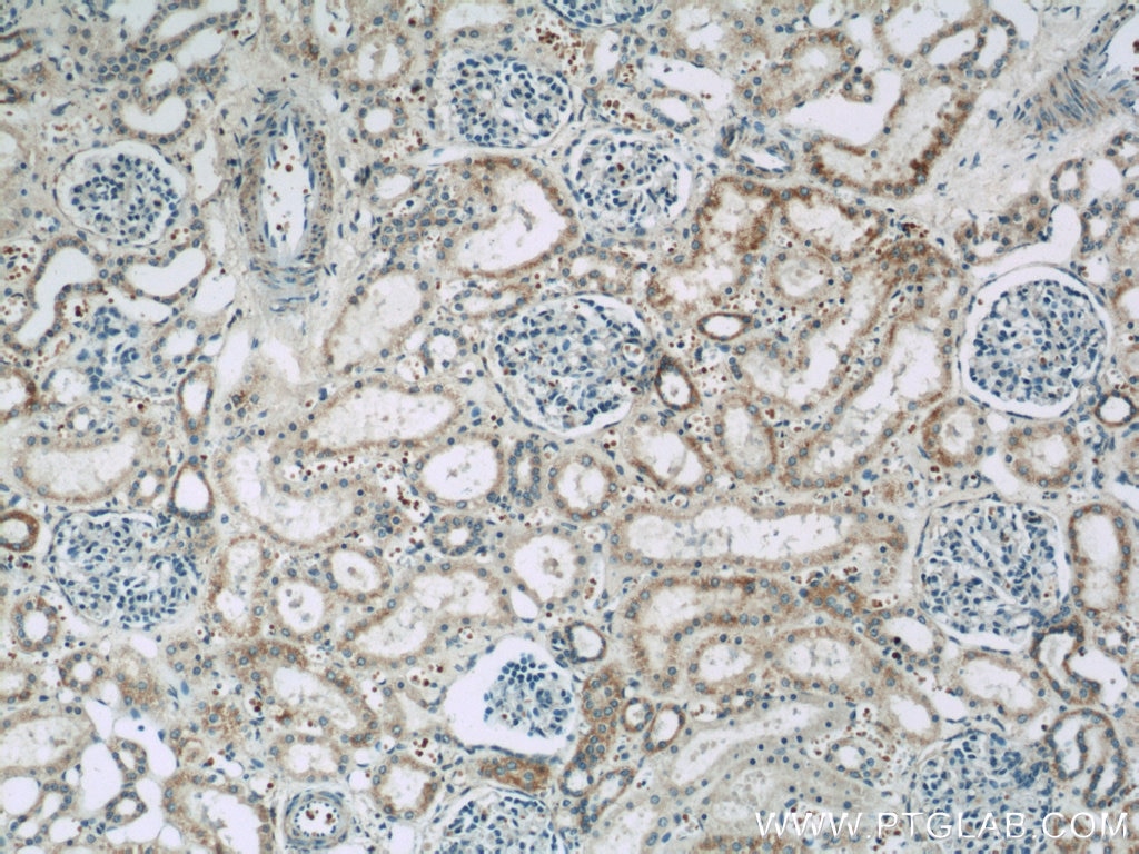 Immunohistochemistry (IHC) staining of human kidney tissue using DMXL2 Polyclonal antibody (24415-1-AP)