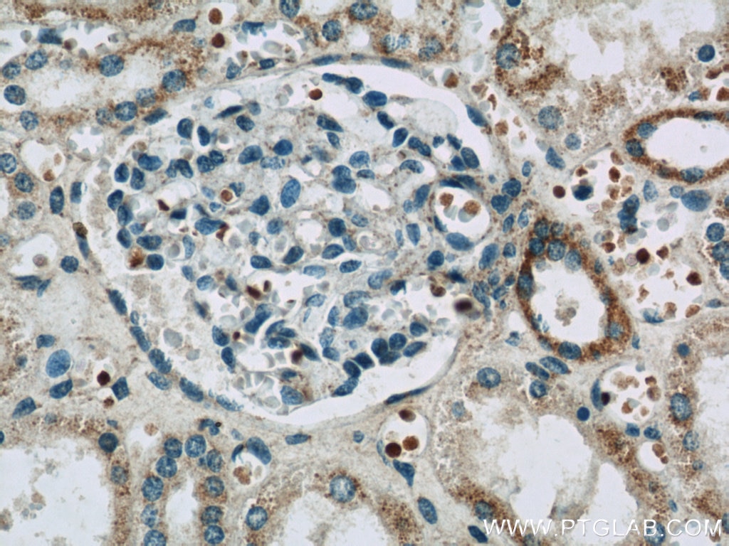 Immunohistochemistry (IHC) staining of human kidney tissue using DMXL2 Polyclonal antibody (24415-1-AP)