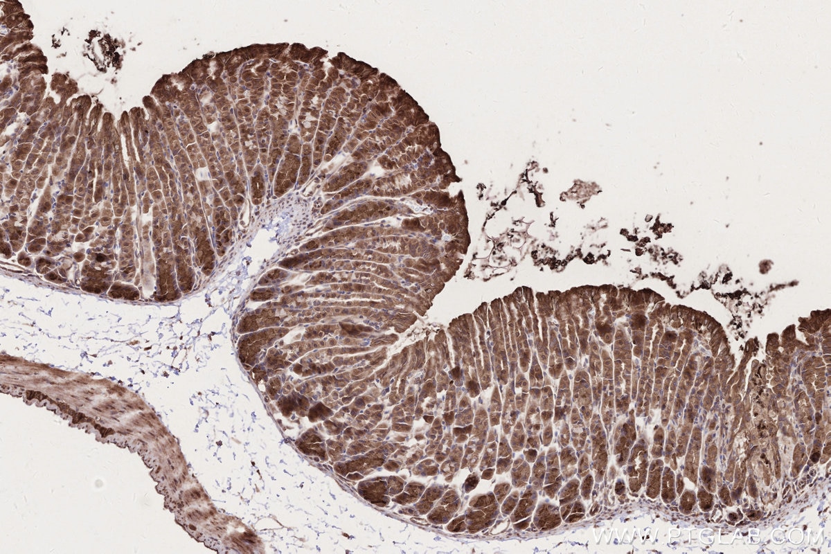 IHC staining of mouse stomach using 24415-1-AP Immunohistochemistry (IHC) staining of mouse stomach tissue using DMXL2 Polyclonal antibody (24415-1-AP)