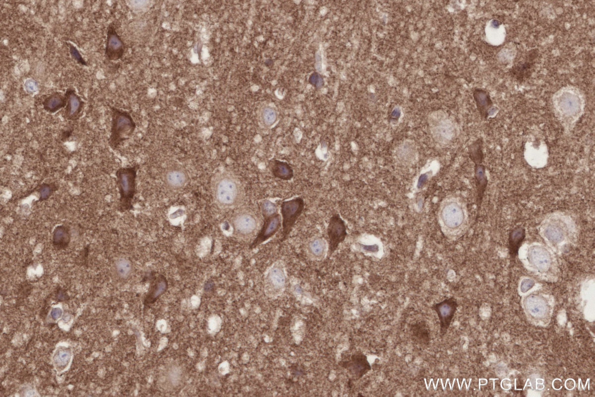 Immunohistochemistry (IHC) staining of mouse brain tissue using DMXL2 Polyclonal antibody (24415-1-AP)