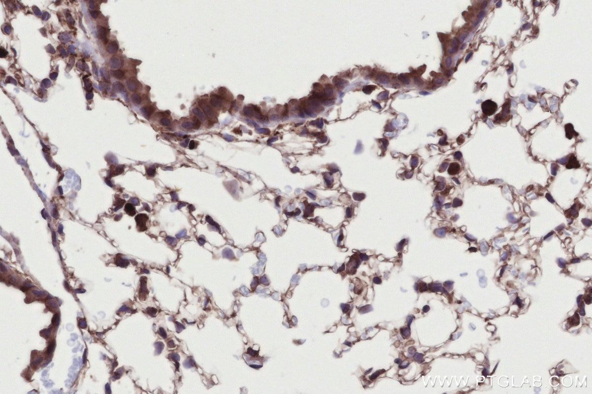 IHC staining of mouse lung using 24415-1-AP Immunohistochemistry (IHC) staining of mouse lung tissue using DMXL2 Polyclonal antibody (24415-1-AP)