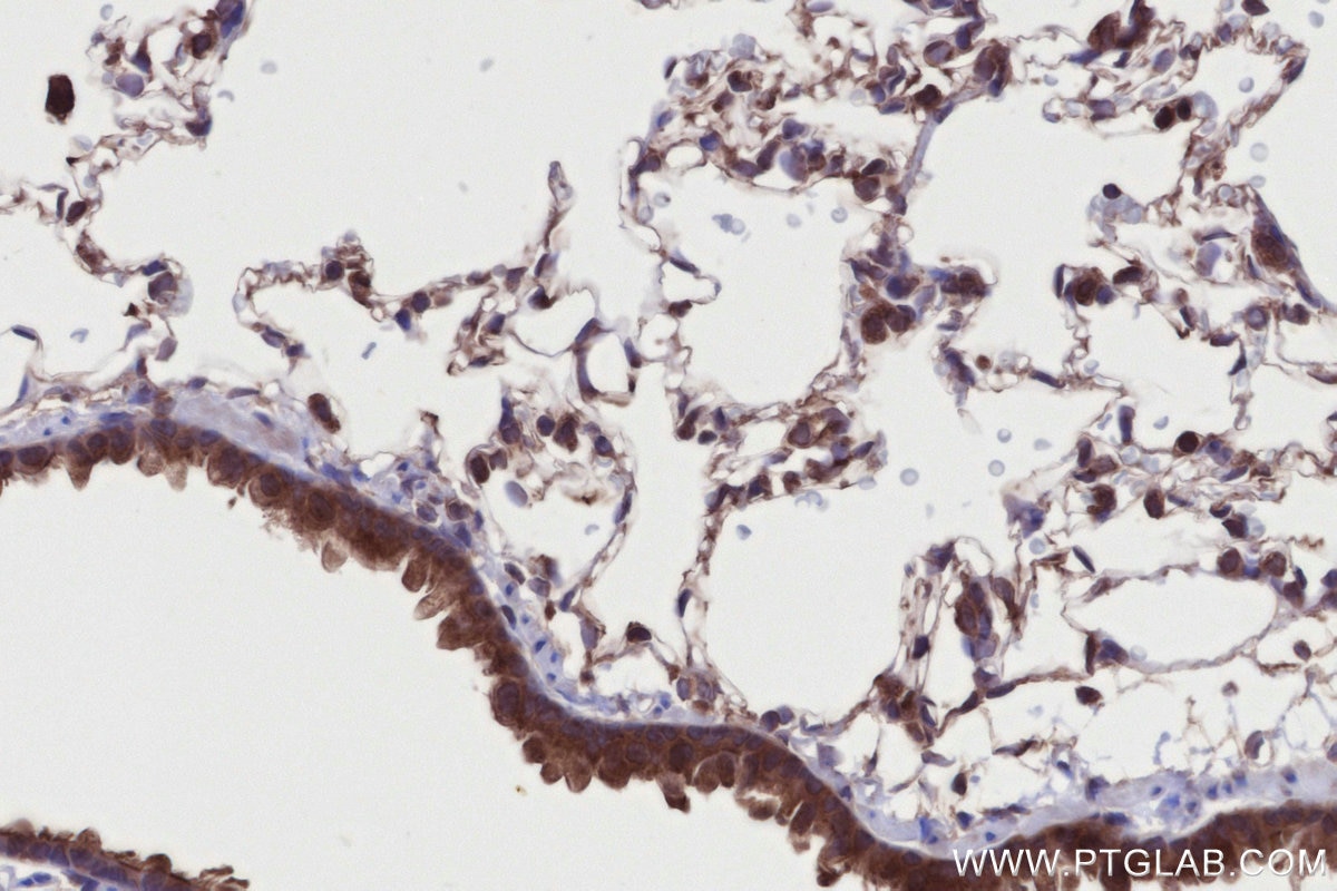 IHC staining of rat lung using 24415-1-AP Immunohistochemistry (IHC) staining of rat lung tissue using DMXL2 Polyclonal antibody (24415-1-AP)