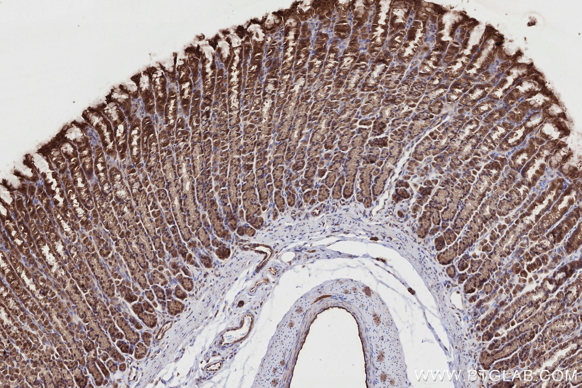 IHC staining of rat stomach using 24415-1-AP Immunohistochemistry (IHC) staining of rat stomach tissue using DMXL2 Polyclonal antibody (24415-1-AP)