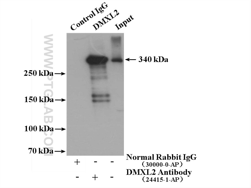 Immunoprecipitation (IP) experiment of mouse brain tissue using DMXL2 Polyclonal antibody (24415-1-AP)